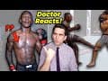 Israel Adesanya's Chest & His PERFECT Leg Kicks! Doctor Reacts to UFC 253